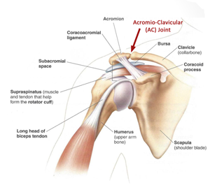 AC Joint Pain Treatment Perth  Shoulder Surgery Cockburn