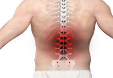 Back Pain